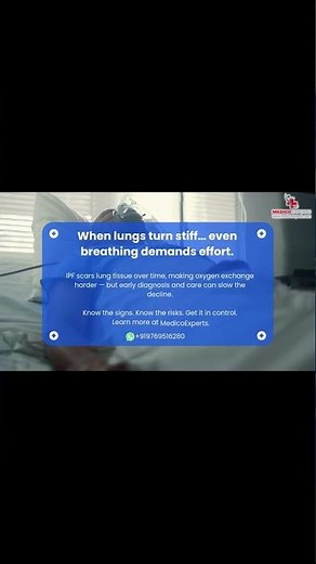 Idiopathic Pulmonary Fibrosis