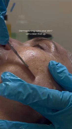 Let’s set the record straight — dermaplaning doesn’t ruin your skin. In fact, when done professionally (not at home with drugstore razors), it’s one of the most effective ways to refresh your complexion safely and naturally. Here’s the truth 💯 · Removes dead skin buildup — allowing your skincare to absorb up to 80% better. · Gently exfoliates without chemicals — ideal for sensitive and acne-prone skin. · Smooths texture & peach fuzz — makeup glides on seamlessly, and skin looks instantly bright