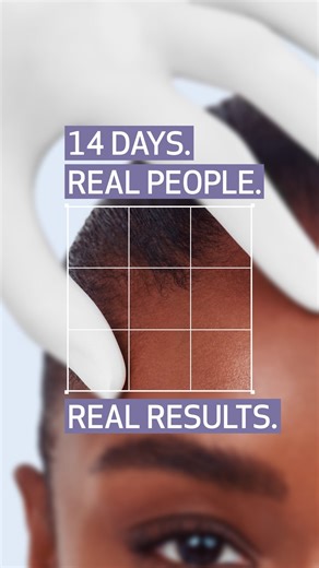 2.6K views · 5 comments | Results at 2 weeks?! You read that right!...