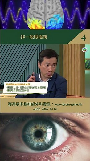 非一般眼眉跳（四） #眼眉跳 #半邊臉肌抽搐痙攣症 #Hemifacialspasm