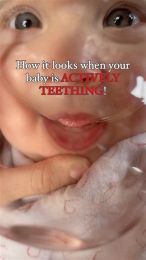 Active Teething 🦷😳😮‍💨 We all dread it, right. Unfortunately teething is something we parents can’t avoid and is part of every child’s infancy. Active teething happens usually any time after 5 months (although there are a few babies that are born with a tooth or get their first tooth before 4 months- which is not very common.) All babies go on their own timeline when it comes to teething ( Elliot had his first two teeth at 5 months & Josie just now at 9 months). The most painful part of teeth