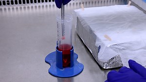 Isolation of Primary Mouse Lung Endothelial Cells