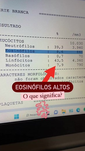 Eosinófilos Elevados: O Que Significa Para Sua Saúde?