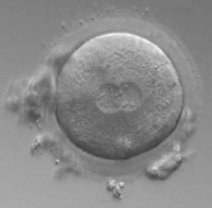 受精卵の発育過程【写真&動画】【体外受精】