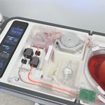 Organ Recovery Systems’ LifePort® Liver Transporter Preserves First Livers for Transplant as Part of the PILOT™ Continued Access Study