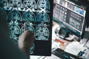 There are specific brain cells that enable intelligent behaviour, scientists say