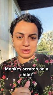 Monkey Scratch in Child – Do You Need Rabies Vaccine?