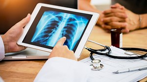 Report shows rise in cancer rates in adults under age 50