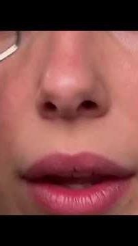"It made me look younger and I wanted to look like Dua Lipa."