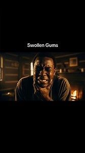 Toothache Pain & Swelling Relief | Clove Oil