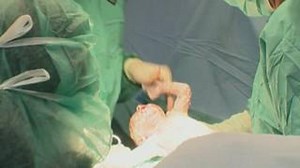 Nach jahrelangem Rückgang: Geburtenrate in Deutschland steigt wieder