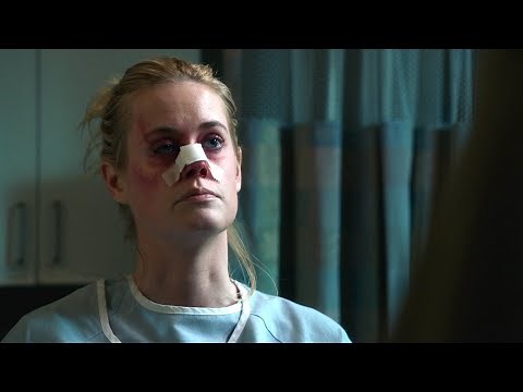 Blue Bloods - Broken Nose