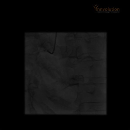 #innvolution #healthcare #heartcare #heart #cardiac #icd #medtech #cardiology #premier #elite #cathlab #medicaltechnology #medicalequipment #angiography | Innvolution Healthcare Private Limited