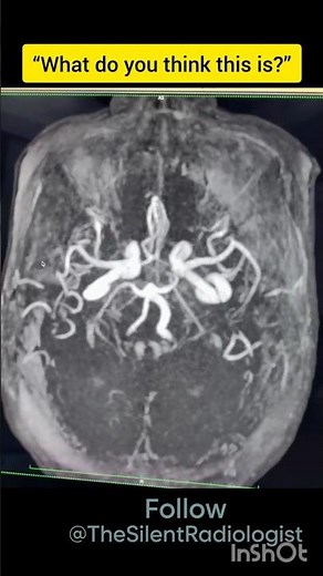 Brain Map Quiz! 🧠 Can You Spot the Circle of Willis?