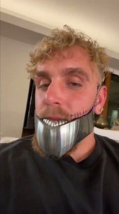 Jack Paul shows his new jaw new teeth #WWE #boxing | WWE Updates