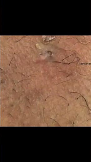 A Very Gritty DPOW