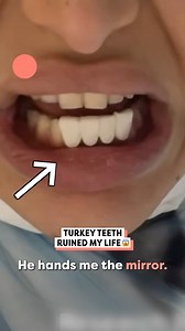 1.4M views · 2.4K reactions | He ruined my beautiful face  | Happiest | Facebook