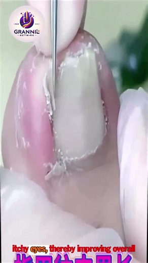 8.7K views · 73 reactions | Essential Tips for Elderly Toenails To Improve Nail Appearance  #SafeSteps #WellnessSeniors #DiabeticFootCare | Grand15 | Facebook