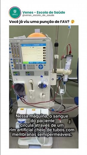 Você já viu uma punção de FAV? 🤔