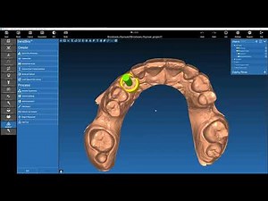 Real Guide - Step 2 Surgical Guide