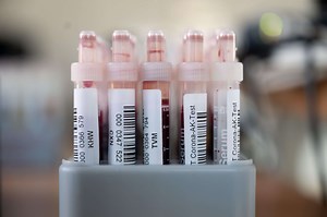 COVID-19 Pool Testing Is a Stopgap Measure To Track and Curb the Pandemic