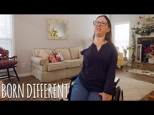 The Human Statue Who’s Turned To Stone | BORN DIFFERENT