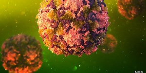This Day in History: Dr. Jonas Salk announces vaccine for polio