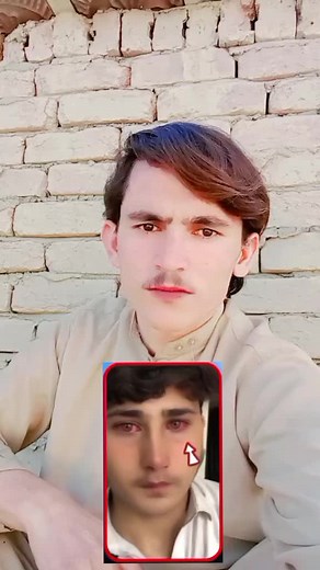 Red Eye Effect Tutorial for Stunning Visuals