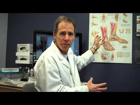 Gastroc Recession -- Treatment, Procedure, and Results