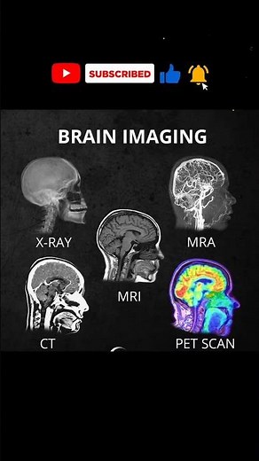 Brain Imaging Techniques Explained 🧠 | MRI vs CT Scan #machine #shortsfeed #ctscan #education