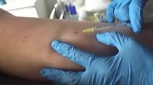 With Dr Martin Kinsella at clinic Great day for our clients having their vein treatment now ready for the Summer!!! | Revitalaser | Facebook