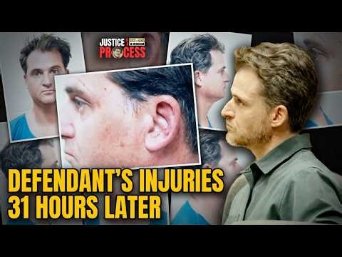 Defense Shows Jury the Defendant's Injuries 31 Hours Later in Gerhardt Konig Attempted Murder Trial
