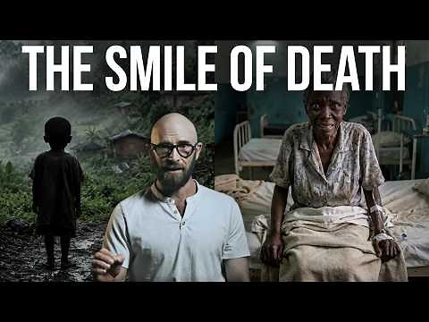 Kuru: The Horrific Laughing Death You Can’t Stop
