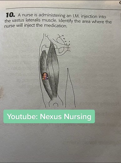 Injection Site in Vastus Lateralis Muscle for Nurses