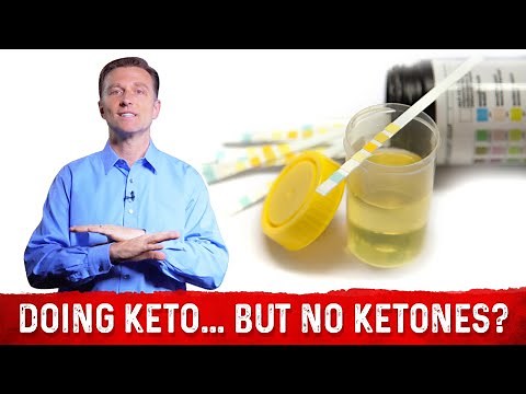 In Ketosis But No Ketones In Urine? – Dr. Berg