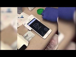 YO home sperm testing kit review– Part II: Low Sperm Count