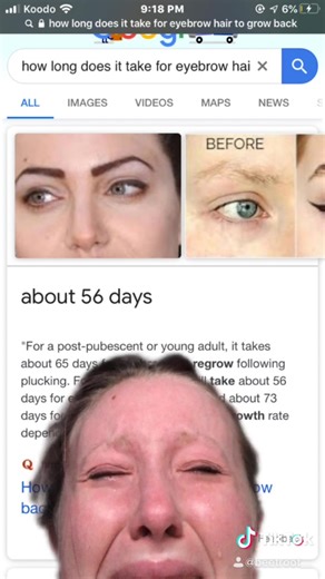 Eyebrow Growth: How Long Does It Take for Eyebrows to Grow Back?