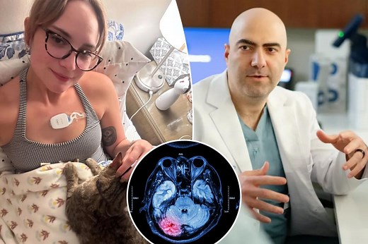 Why so many people are having strokes in their 20s, 30s and 40s: ‘We’ve never had patients so young’