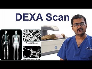 Bone Density Scan (DEXA scan) Dr.Soundar
