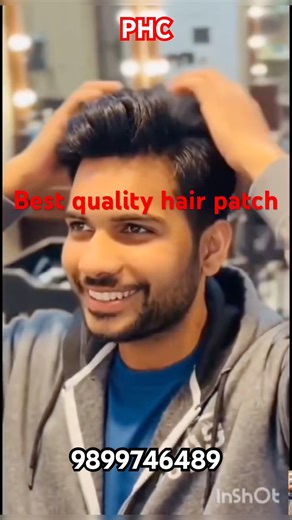 best quality hair patch for men Free demo and consultation ☎️ 9899746489 at reasonable price delhi