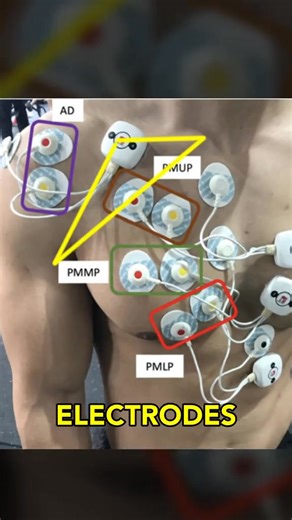 32K views · 294 reactions | THIS Is How You Grow Your Upper Chest! #bodybuilding #upperchest #fitness | Ryan Humiston | Facebook