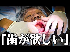 TOOTHLESS | HOMELESS MAN GOING TO THE DENTIST FOT THE FIRST TIME...