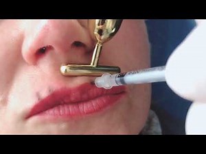 Código de Barras con Toxina Botulínica