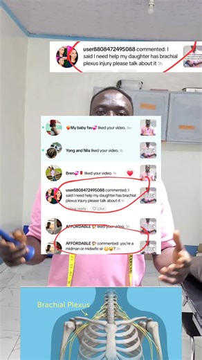 Explore the essentials of the brachial plexus: anatomy, injury signs, and care tips every midwife should know. Boost your knowledge for better newborn outcomes and expert patient support. Perfect for midwives, doulas, and birth professionals passionate about neonatal nerve health. Stay informed and empower your practice! What’s your experience with brachial plexus cases? Share your stories or questions below and let’s learn together! #MidwifeLife #NeonatalCare #BrachialPlexusInjury #BirthSupport