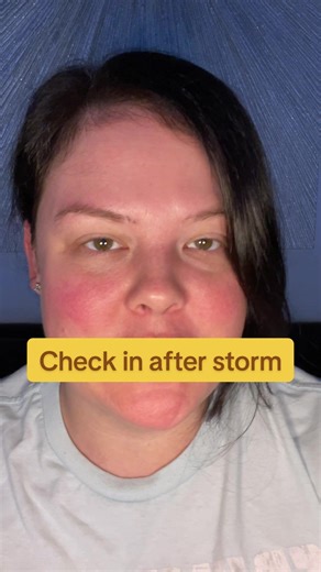 Hereditary Angioedema — checking in with all my HAE friends stuck in this nasty storm. I hope everyone had a low symptom time! #hereditaryangioedema