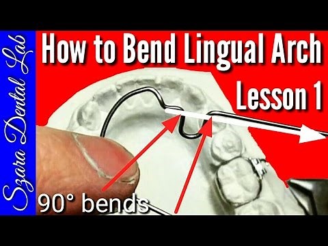Wire Bending Lesson Lingual Arch #1