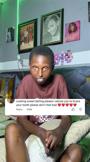 Scleroderma's Impact on Oral Health and Teeth Care