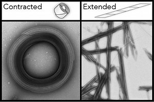 Bacteria's Killer Trait Becomes New Drug Delivery System | Clinical And Molecular Dx