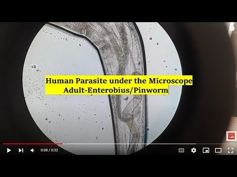 Adult Pinworm under the Microscope