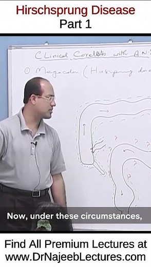 Hirschsprung Disease Part 1. #drnajeeb #shortvideo #youtubeshorts